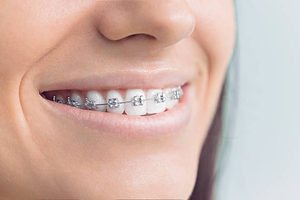 Full Mouth Reconstruction in Blackwater, AZ